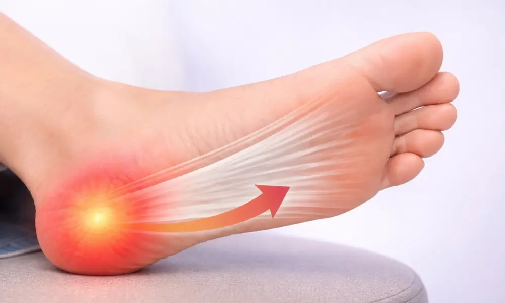 Fascite plantare: perché il dolore al tallone al risveglio non è solo il piede